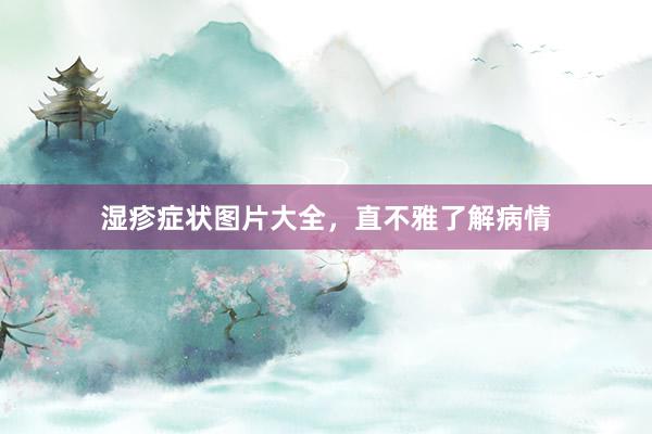 湿疹症状图片大全，直不雅了解病情